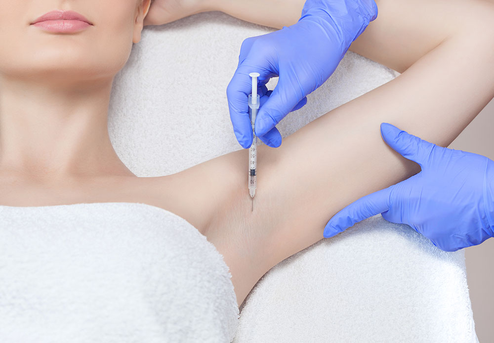 The doctor makes intramuscular injections of botulinum toxin in the underarm area against hyperhidrosis.