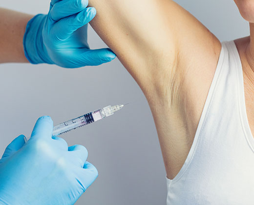 The doctor making intramuscular injection with syringe of botulinum toxin in the armpit against hyperhidrosis.